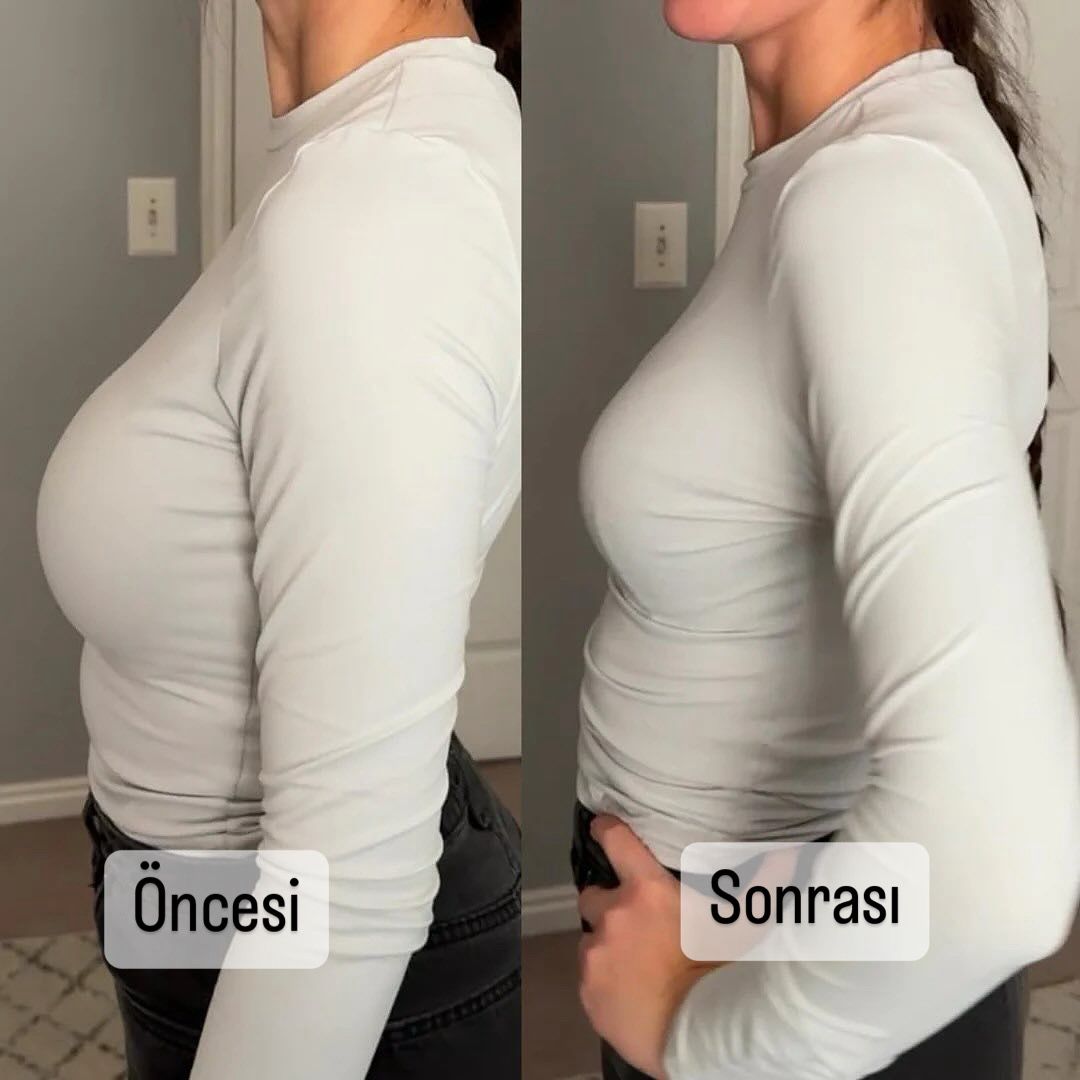 Belmira Göğüs Süzen Sütyen